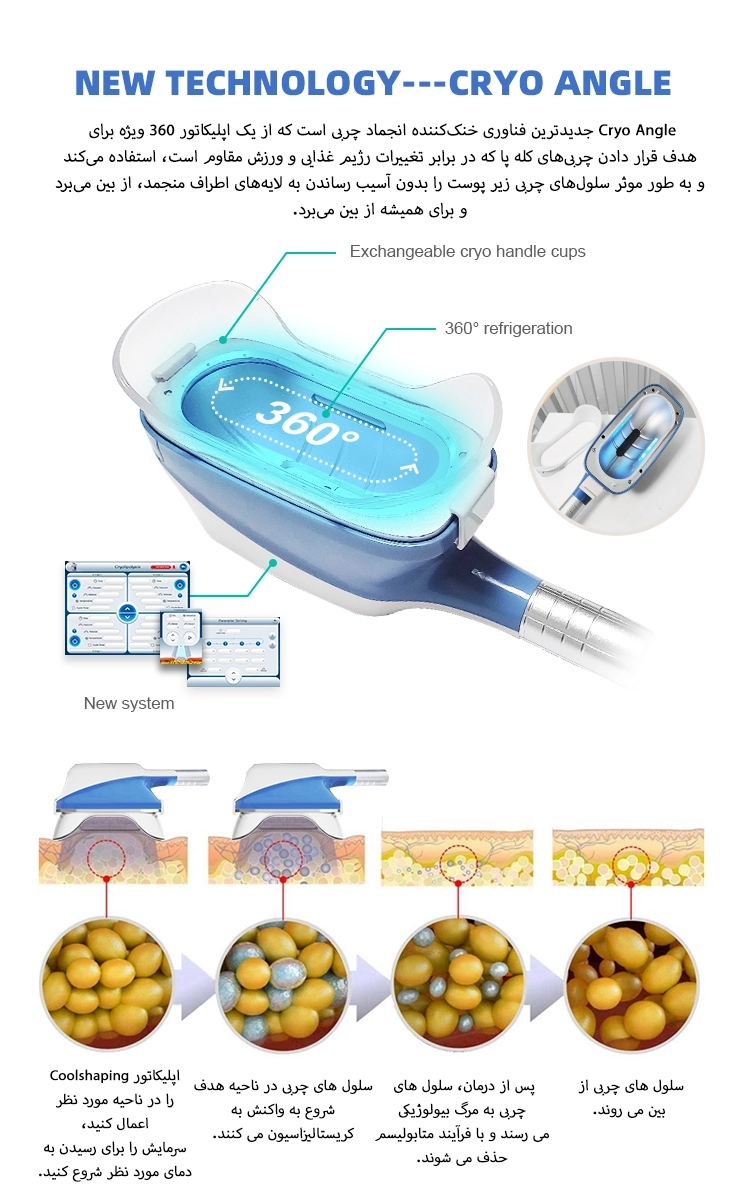 دستگاه کرایولیپولیز 360 پرتابل