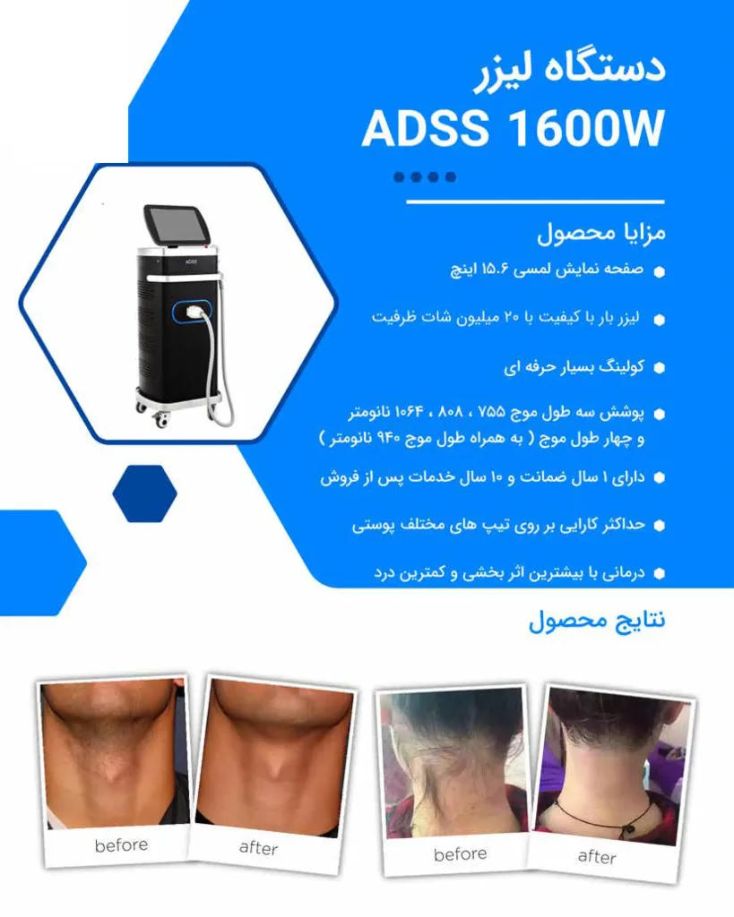 دستگاه لیزر موهای زائد چهار طول موج 1600W برند ADDS