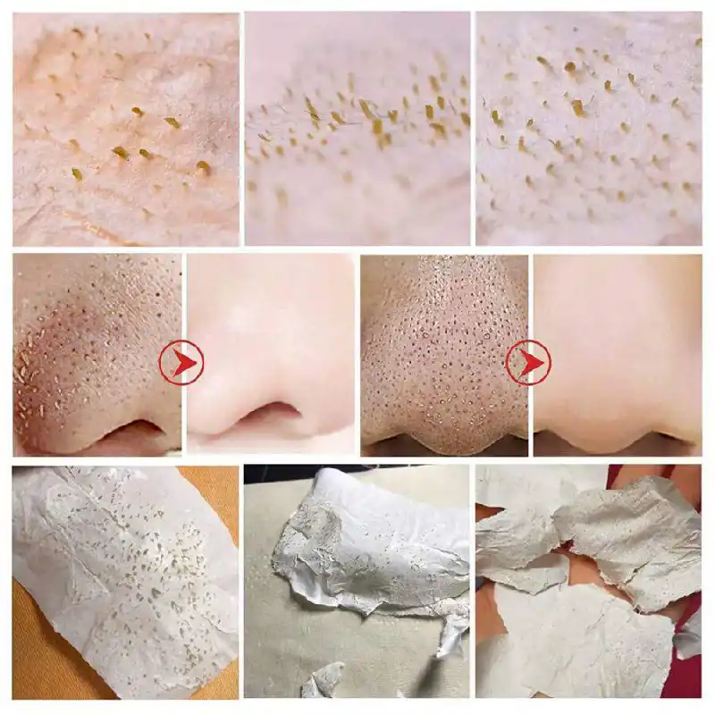 Lacquered nose glue 0002 چسب بینی لاکی لانبنا