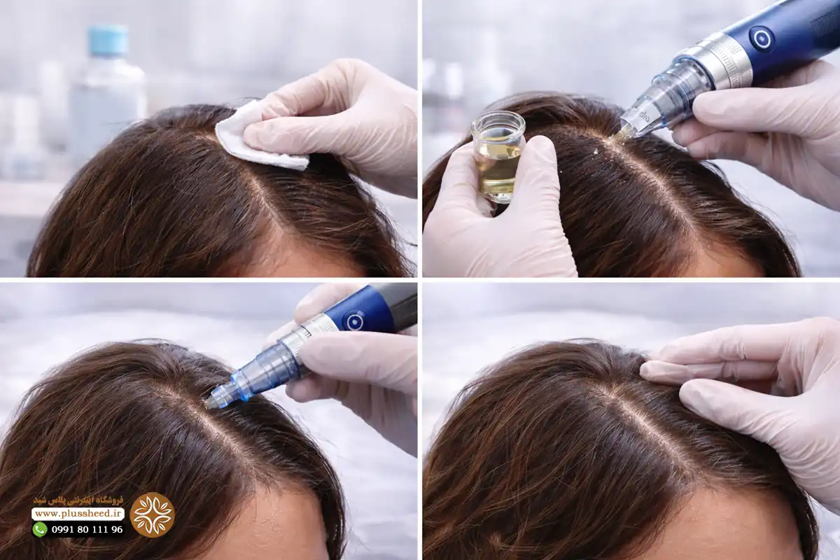 Complete introduction of Dr.Pen A6 cartridge 00004 کارتریج دکترپن A6 | معرفی انواع کارتریج، مزو مو و جدول مقایسه