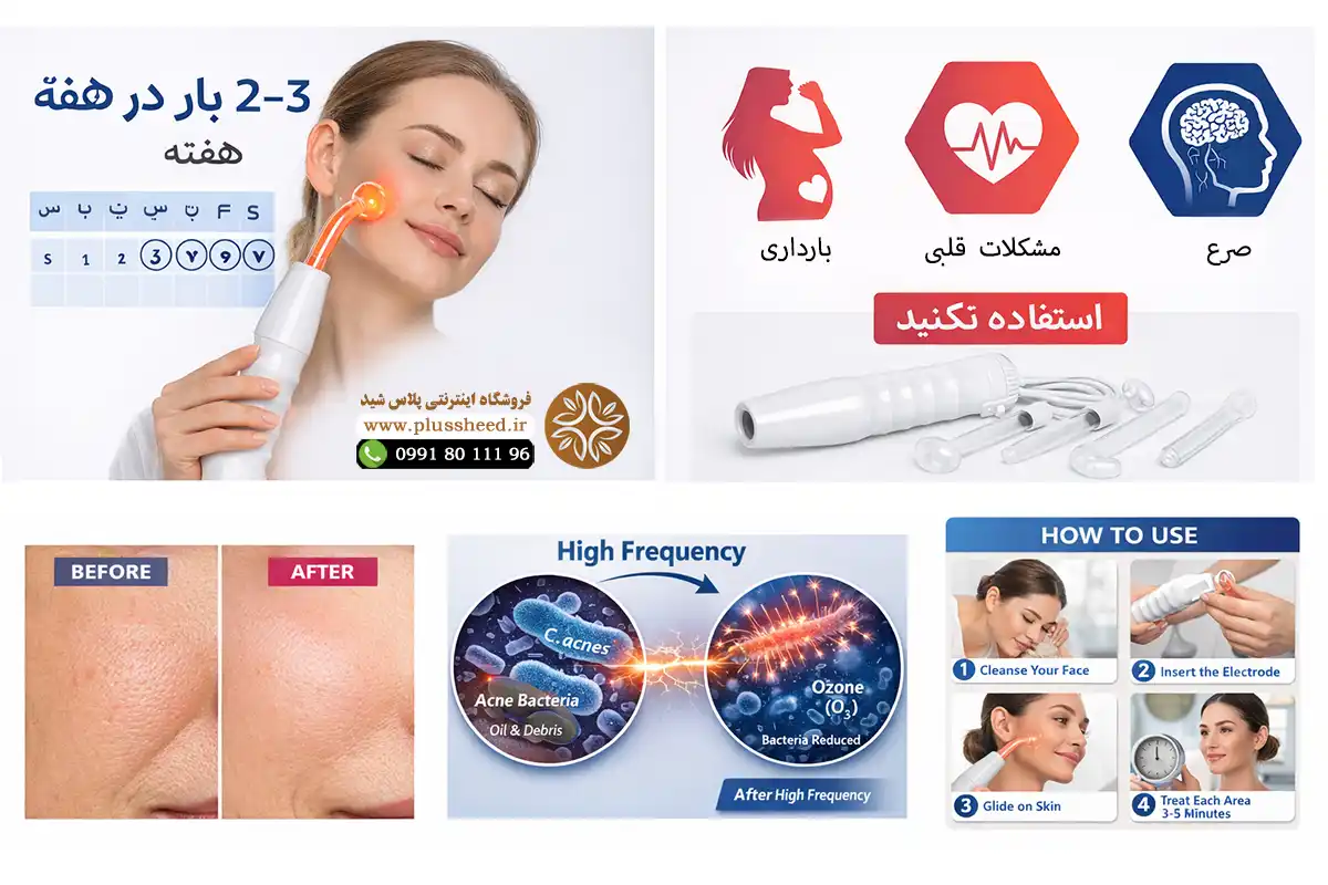 Facial High Frequency 000004 خرید دستگاه هایفرکانسی پرتابل صورت