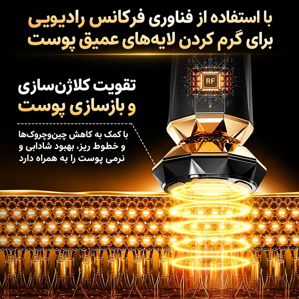 anlan-adry31-diamond-rf 0004 نمای نزدیک سری فلزی طلایی دستگاه ANLAN ADRY31