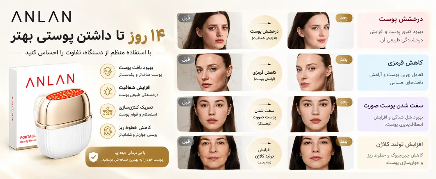 anlan-adry51-beauty-device-se 0007 عملکرد دستگاه RF چندکاره ANLAN مدل ADRY51